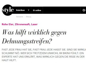 Sytle Magazin Dehnungsstreifen