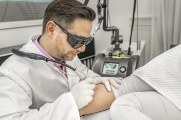 Besenreisser - Laser - Dr. Schnitzler Zürich-Enge