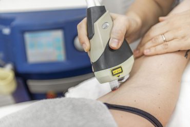 Enthaarung mit Laser, Enthaarungslaser Depilation Laser