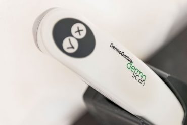 Skin cancer control skin check birthmark control