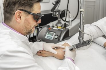 Tattoo removal Laser-Pico Dr Schnitzler Zurich-Enge