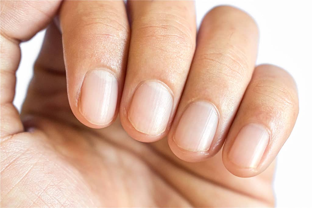 Treatments for Fungus on Toenails and Fingernails » derma competence center