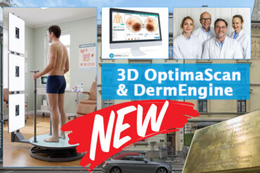 Hautkrebsvorsorge & Muttermalcheck jetzt mit dem 3D Ganzkörpersanner